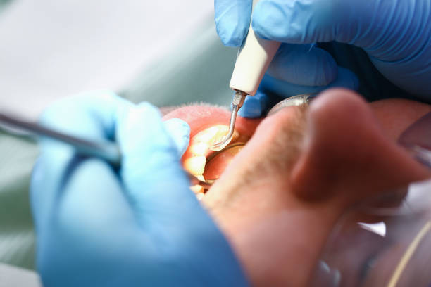 Best Emergency Treatment for Dental Infections or Abscesses in Morton, TX
