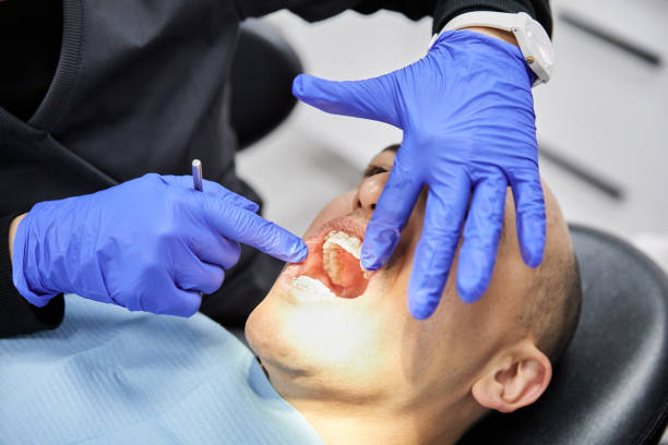 Best Emergency Denture Repair in Morton, TX